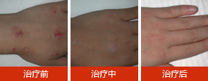 警惕皮肤瘙痒的3大危害