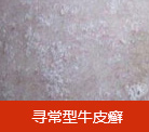 中药渗透活化免疫疗法  全面攻克“不死的癌症”牛皮癣