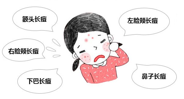 南京看青春痘去哪里好