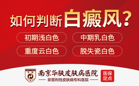 南京看白癜风的医院
