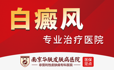 南京白癜风医院有哪些