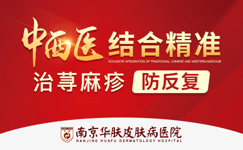 南京荨麻疹专科医院怎么预约